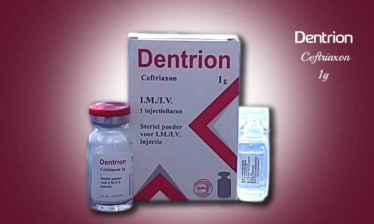 Dentrion